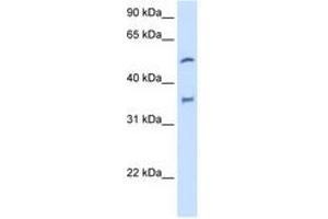 Image no. 2 for anti-Cytochrome P450, Family 2, Subfamily D, Polypeptide 6 (CYP2D6) (AA 101-150) antibody (ABIN204973) (CYP2D6 antibody  (AA 101-150))