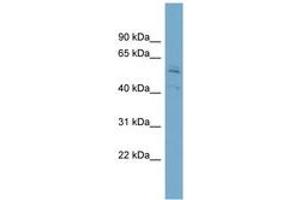 Image no. 1 for anti-Syntrophin, beta 1 (Dystrophin-Associated Protein A1, 59kDa, Basic Component 1) (SNTB1) (AA 71-120) antibody (ABIN6743196)