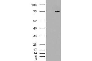 Image no. 2 for anti-Serine/threonine-Protein Phosphatase 4 Regulatory Subunit 3A (SMEK1) (Internal Region) antibody (ABIN375112)