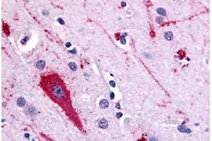 Human Brain, Cortex (formalin-fixed, paraffin-embedded) stained with HTR5A antibody ABIN213372 at 10 ug/ml followed by biotinylated goat anti-rabbit IgG secondary antibody ABIN481713, alkaline phosphatase-streptavidin and chromogen. (Serotonin Receptor 5A antibody  (Extracellular Domain))