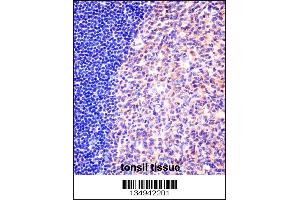 Immunohistochemistry (IHC) image for anti-Minichromosome Maintenance Complex Component 6 (MCM6) (AA 80-109), (N-Term) antibody (ABIN5536986)