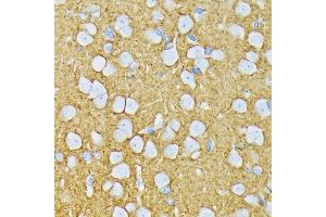 Immunohistochemistry of paraffin-embedded rat brain using GRIK2 Rabbit mAb (ABIN7267415) at dilution of 1:100 (40x lens). (GRIK2 antibody)