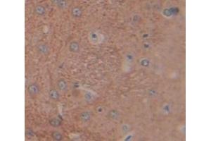 Used in DAB staining on fromalin fixed paraffin- embedded Kidney tissue (LCNL1 antibody  (AA 2-164))