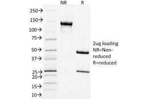 SDS-PAGE Analysis Purified CD3e Mouse Monoclonal Antibody (C3e/1931).