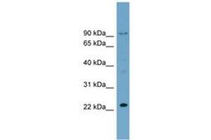 Image no. 1 for anti-Ribosomal L24 Domain Containing 1 (RSL24D1) (C-Term) antibody (ABIN6744099) (RSL24D1 antibody  (C-Term))