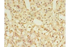Immunohistochemistry of paraffin-embedded human adrenal gland tissue using ABIN7153339 at dilution of 1:100 (GPR3 antibody  (AA 300-330))