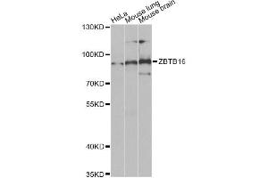 Western blot analysis of extracts of various cell lines, using ZBTB16 Antibody (ABIN5973474) at 1/1000 dilution. (ZBTB16 antibody)