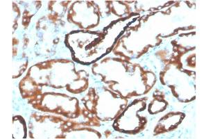 Formalin-fixed, paraffin-embedded human kidney stained with Biotin-conjugated CDH16Mouse Monoclonal Antibody (CDH16/2125). (Cadherin-16 antibody  (AA 371-507) (Biotin))