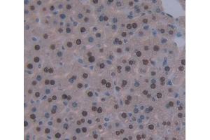 Immunohistochemistry (IHC) image for anti-DNA (Cytosine-5-)-Methyltransferase 3 beta (DNMT3B) (AA 581-859) antibody (ABIN1867610)