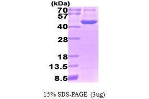 Figure annotation denotes ug of protein loaded and % gel used. (Ornithine Aminotransferase (OAT) (AA 33-439) Peptide)