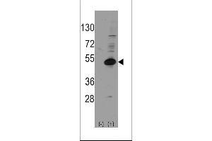 Western blot analysis of NROB1 (arrow) using rabbit polyclonal NROB1 Antibody (Human C-term) (ABIN389158 and ABIN2839324). (NR0B1 antibody  (C-Term))