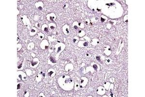 LPL antibody immunohistochemistry analysis in formalin fixed and paraffin embedded human brain tissue. (Lipoprotein Lipase antibody  (AA 300-327))