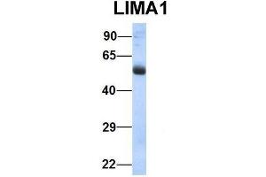 Host:  Rabbit  Target Name:  LIMA1  Sample Type:  Human Fetal Lung  Antibody Dilution:  1. (LIMA1 antibody  (N-Term))