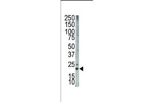 The anti-Bim BH3 domain Pab (ABIN388101 and ABIN2846193) is used in Western blot to detect Bim BH3 in HL-60 cell lysate. (BIM antibody  (AA 130-165))