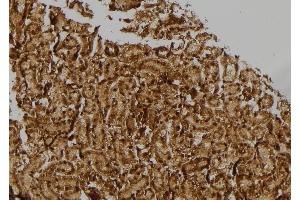 ABIN6257373 and ABIN6274770 at 1/100 staining Rat kidney tissue by IHC-P. (RPL17 antibody  (C-Term))