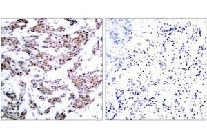 Image no. 2 for anti-Myocyte Enhancer Factor 2A (MEF2A) (pThr312) antibody (ABIN196683) (MEF2A antibody  (pThr312))