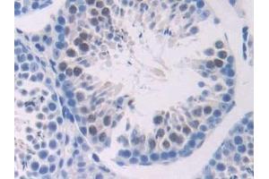 Immunohistochemistry (IHC) image for anti-Adenylate Cyclase 6 (ADCY6) (AA 314-501) antibody (ABIN7441871)
