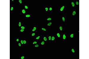 Immunofluorescence (IF) image for anti-Histone Cluster 1, H3a (HIST1H3A) (acLys56) antibody (ABIN7127267)