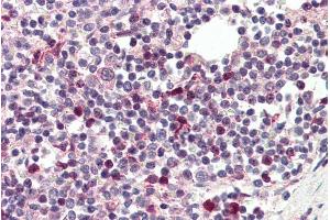 ABIN334506 (5µg/ml) staining of paraffin embedded Human Spleen. (TFEC antibody  (Internal Region))