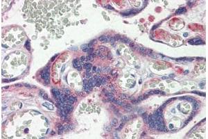 Human Placenta: Formalin-Fixed, Paraffin-Embedded (FFPE) (Claudin 6 antibody  (Val118))