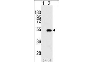 Western blot analysis of SYMD2 (arrow) using rabbit polyclonal SYMD2 Antibody (N-term) (ABIN387897 and ABIN2844146). (SMYD2A antibody  (N-Term))