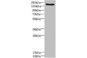 Western blot All lanes: LY75 antibody IgG at 1. (LY75/DEC-205 antibody  (AA 440-680))