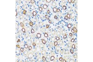 Immunohistochemistry of paraffin-embedded mouse kidney using  antibody (ABIN7265652) at dilution of 1:100 (40x lens). (AQP2 antibody  (AA 147-271))