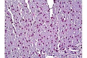 Anti-Myosin, Cardiac Heavy Chain antibody IHC of human heart. (MYL2 antibody)