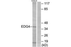 Western Blotting (WB) image for anti-Lysophosphatidic Acid Receptor 2 (LPAR2) (AA 290-339) antibody (ABIN2890765) (EDG4 antibody  (AA 290-339))