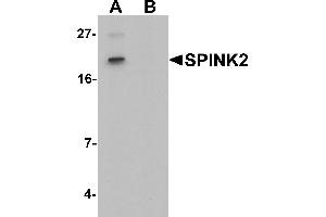 Western blot analysis of SPINK2 in mouse heart tissue lysate with SPINK2 antibody at 1 µg/mL in (A) the absence and (B) the presence of blocking peptide.