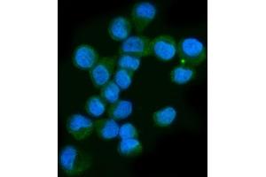 IF analysis of Neurofibromin/NF1 using anti-Neurofibromin/NF1 antibody (ABIN7600197).