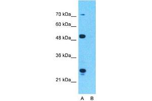 Host:  Rabbit  Target Name:  CPT1A  Sample Type:  293T  Lane A:  Primary Antibody  Lane B:  Primary Antibody + Blocking Peptide  Primary Antibody Concentration:  1ug/ml  Peptide Concentration:  5ug/ml  Lysate Quantity:  25ug/lane/lane  Gel Concentration:  0. (CPT1A antibody  (Middle Region))