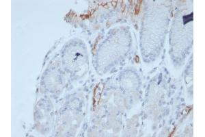 Formalin-fixed, paraffin-embedded human stomach stained with MUC2 Recombinant Mouse Monoclonal Antibody (rMLP/842). (Recombinant MUC2 antibody)