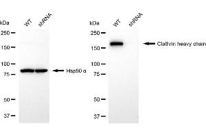 Western blotting analysis using clathrin heavy chain antibody (ABIN7798091). (Recombinant Clathrin Heavy Chain (CLTC) antibody)