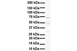 WB Suggested Anti-LBX1 antibody Titration: 1 ug/mL Sample Type: Human heart (Lbx1 antibody  (Middle Region))