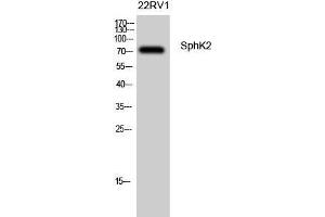Western Blot (WB) analysis of 22RV1 cells using SphK2 Polyclonal Antibody. (SPHK2 antibody  (Tyr754))