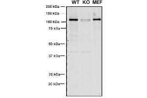 Western Blotting (WB) image for anti-Vacuolar Protein Sorting 35 (VPS35) antibody (Atto 594) (ABIN6932960)