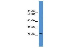 DGAT2L7 antibody used at 0. (DGAT2L7P antibody  (C-Term))