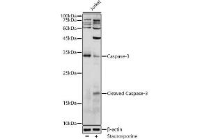 Western blot analysis of extracts of Jurkat cells, using Caspase-3 antibody (ABIN6131582, ABIN6137962, ABIN6137964 and ABIN6215049) at 1:1000 dilution. (Caspase 3 antibody  (AA 55-160))