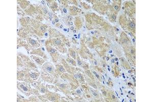 Immunohistochemistry of paraffin-embedded Human liver using WDR48 Polyclonal Antibody at dilution of 1:100 (40x lens). (WDR48 antibody)