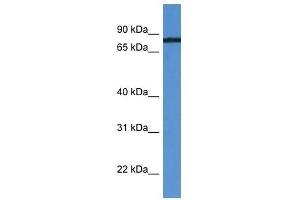 HHIPL1 antibody used at 0. (HHIPL1 antibody  (C-Term))