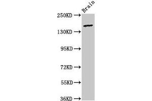 Western Blot Positive WB detected in: Rat brain tissue All lanes: ADGRB2 antibody at 3. (BAI2 antibody  (AA 1371-1545))
