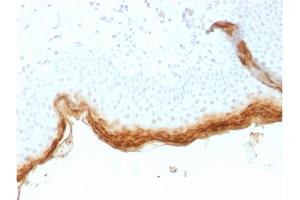 Formalin-fixed, paraffin-embedded human Skin stained with Filaggrin Mouse Recombinant Monoclonal Antibody (rFLG/1561).