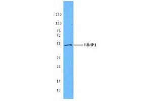 Image no. 1 for anti-Matrix Metallopeptidase 1 (Interstitial Collagenase) (MMP1) antibody (ABIN205496) (MMP1 antibody)