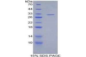 SDS-PAGE analysis of Human Filamin C gamma Protein.