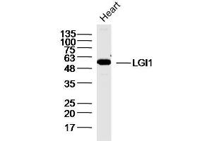Mouse heart lysates probed with GI1 Polyclonal Antibody, unconjugated  at 1:300 overnight at 4°C followed by a conjugated secondary antibody for 60 minutes at 37°C. (LGI1 antibody  (AA 451-557))