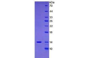 SDS-PAGE analysis of Human FAM19A4 Protein. (FAM19A4 Protein)