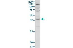 SERPINA3 MaxPab rabbit polyclonal antibody. (SERPINA3 antibody  (AA 1-423))