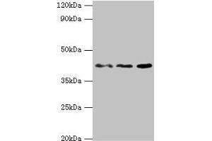Western blot All lanes: MICA antibody at 8 μg/mL Lane 1: MCF-7 whole cell lysate Lane 2: A431 whole cell lysate Lane 3: Mouse Stomach tissue Secondary Goat polyclonal to rabbit IgG at 1/10000 dilution Predicted band size: 43, 32 kDa Observed band size: 43 kDa (MICA antibody  (AA 24-307))