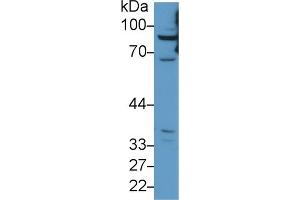 Detection of CPT1A in Human HepG2 cell lysate using Polyclonal Antibody to Carnitine Palmitoyltransferase 1A, Liver (CPT1A) (CPT1A antibody  (AA 191-353))